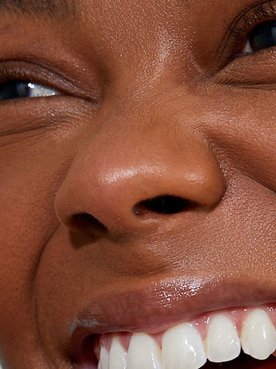 Hyaluronic Acid Under Eyes