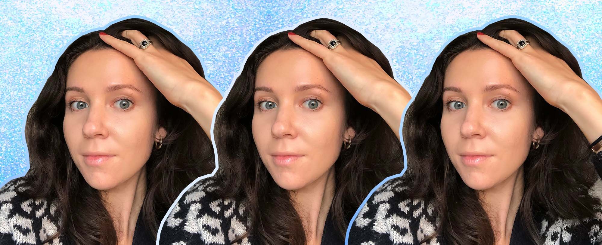 How To Care For Dry Scalp In Winter