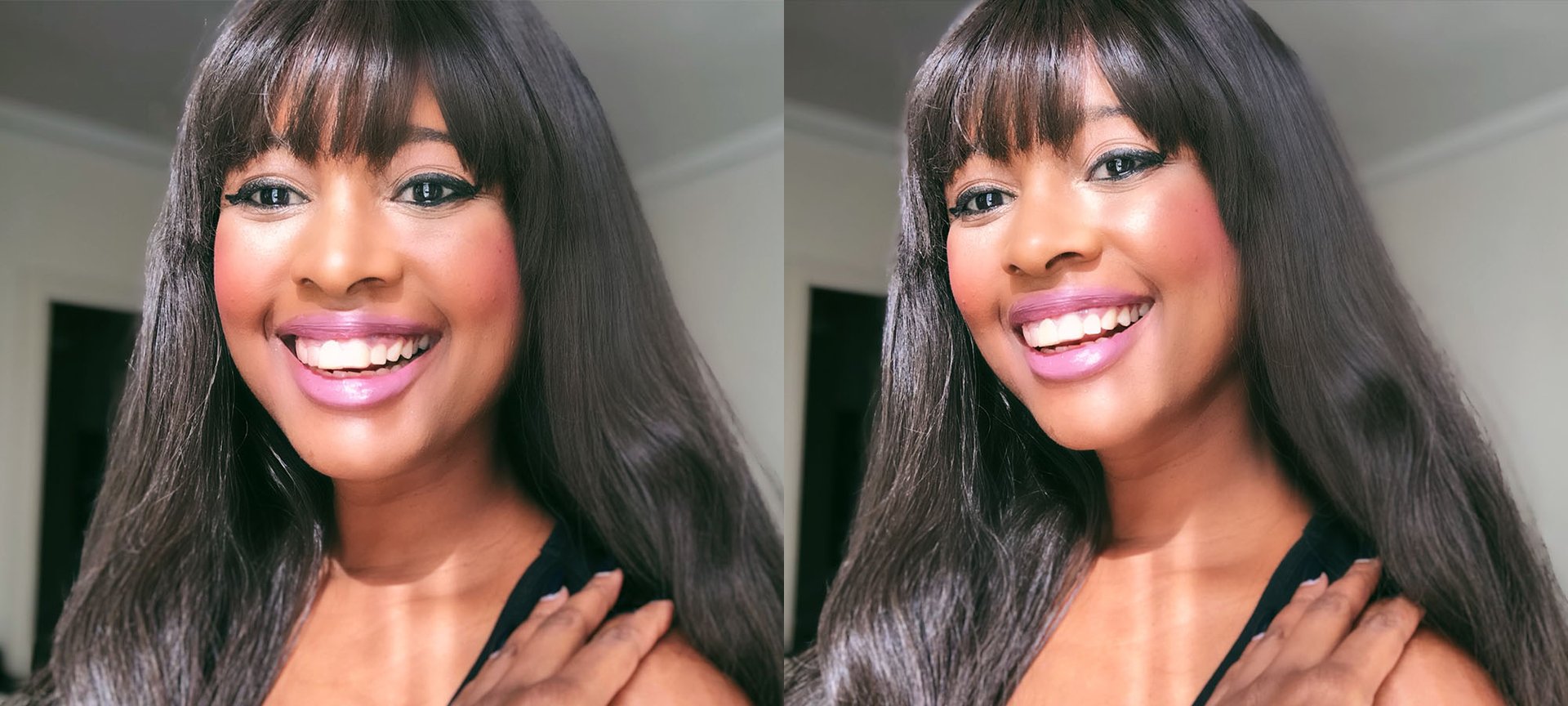 What Is Dolphin Skin CMS Bmag