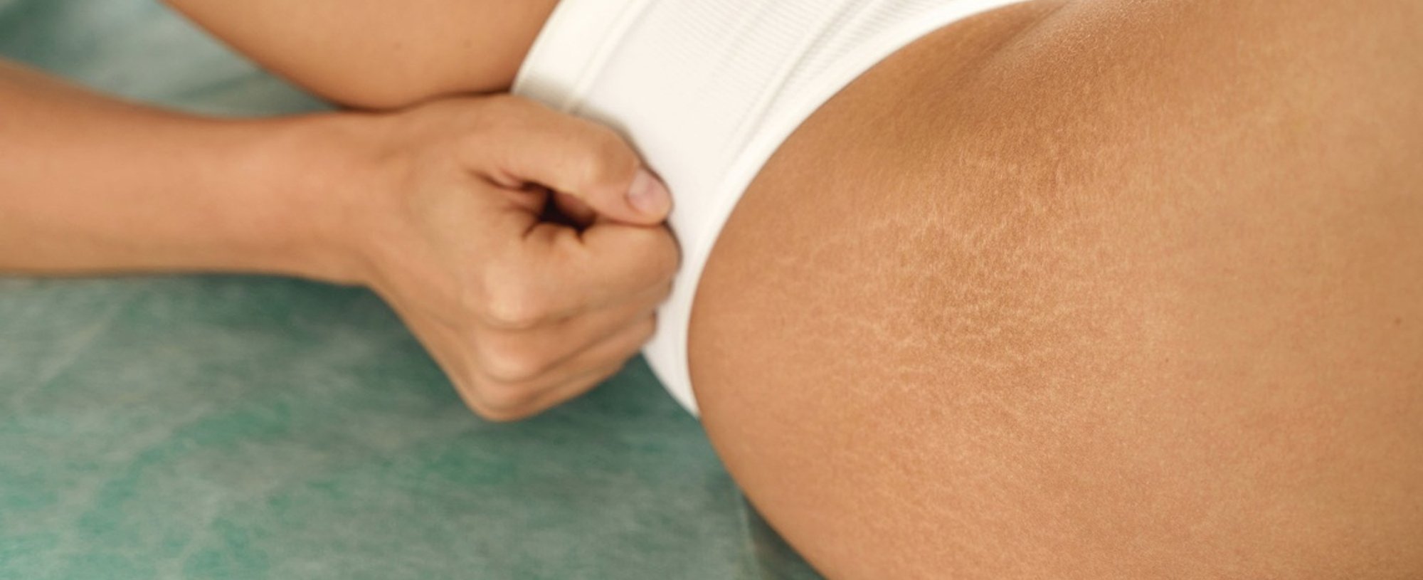 Best Makeup To Cover Stretch Marks