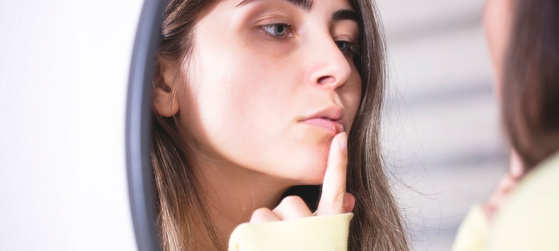 How To Cover Up A Cold Sore