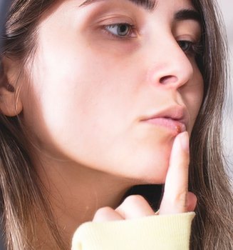How To Cover Up A Cold Sore
