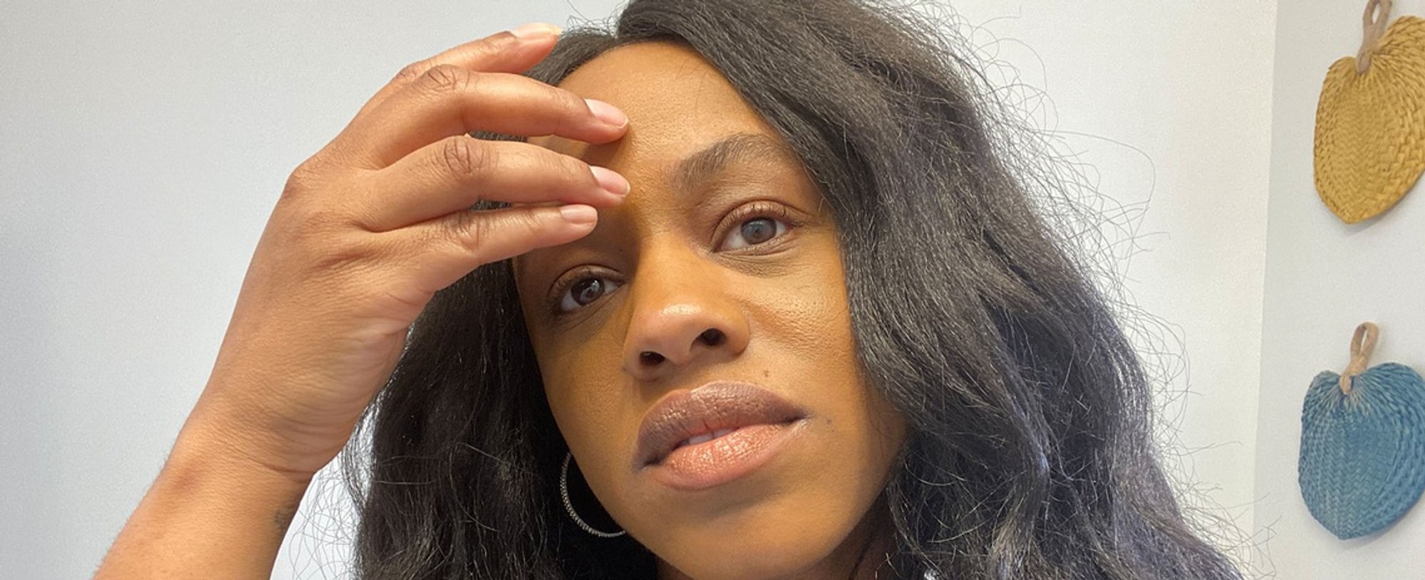 Acne Between Eyebrows