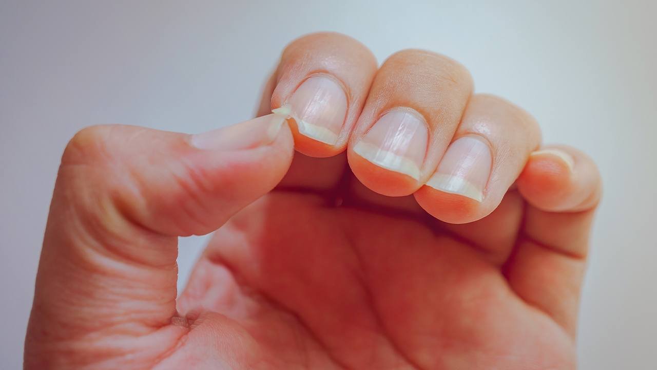 Loreal Paris Article How to Fix a Broken Nail at Home D