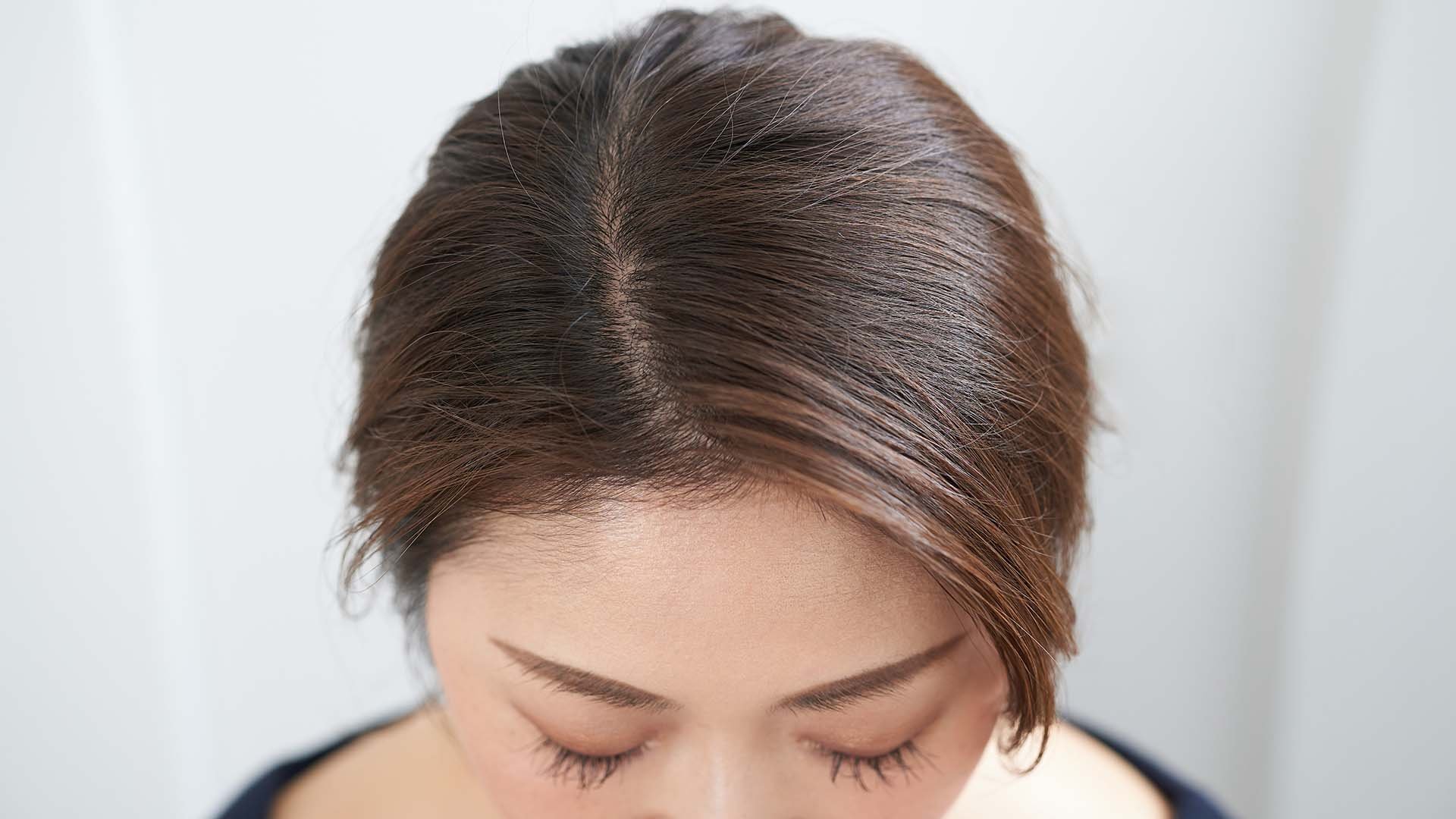 Loreal Paris Article How to Care for a Sensitive Scalp D