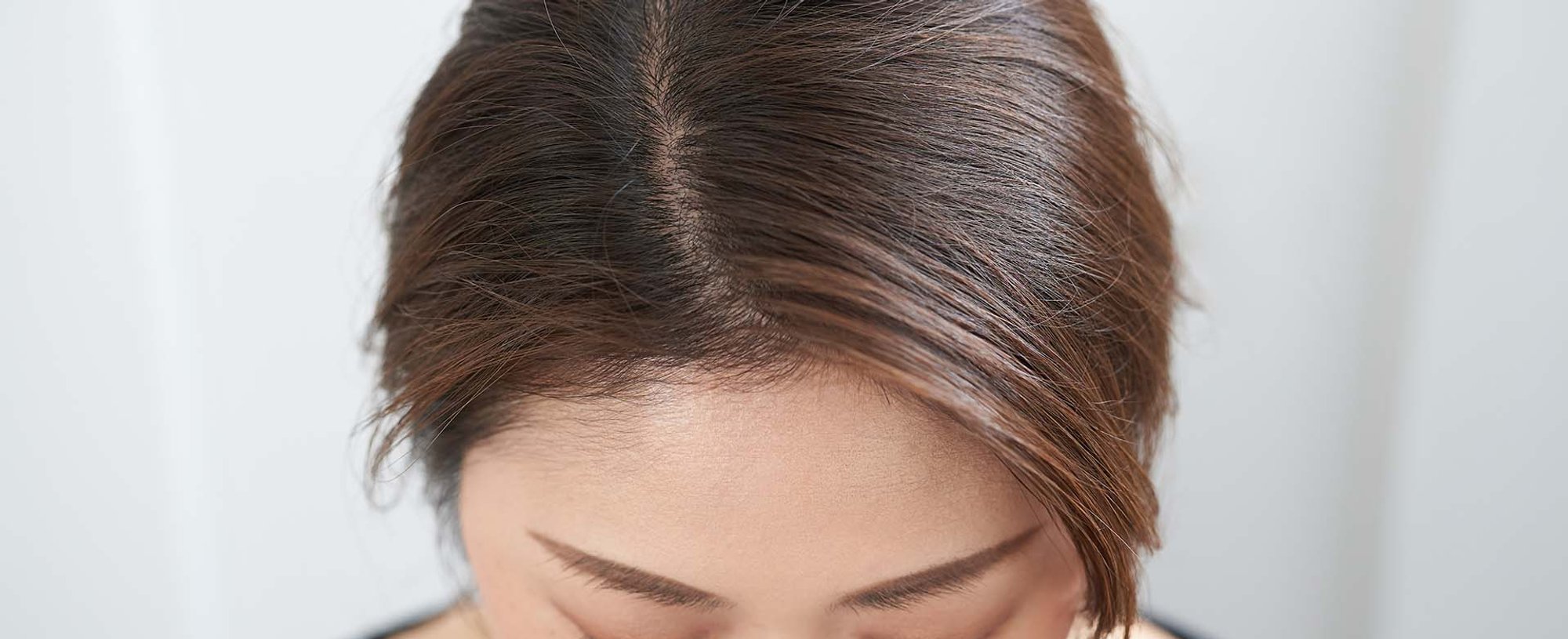 Loreal Paris Article How to Care for a Sensitive Scalp D