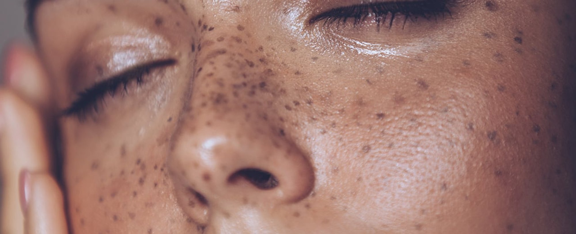 Loreal Paris BMAG Article 8 Reasons You Might Have Oily Skin D