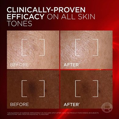09042026 Oap Revitalift Laser Melasyl Creamy Serum Before After Dmi Website