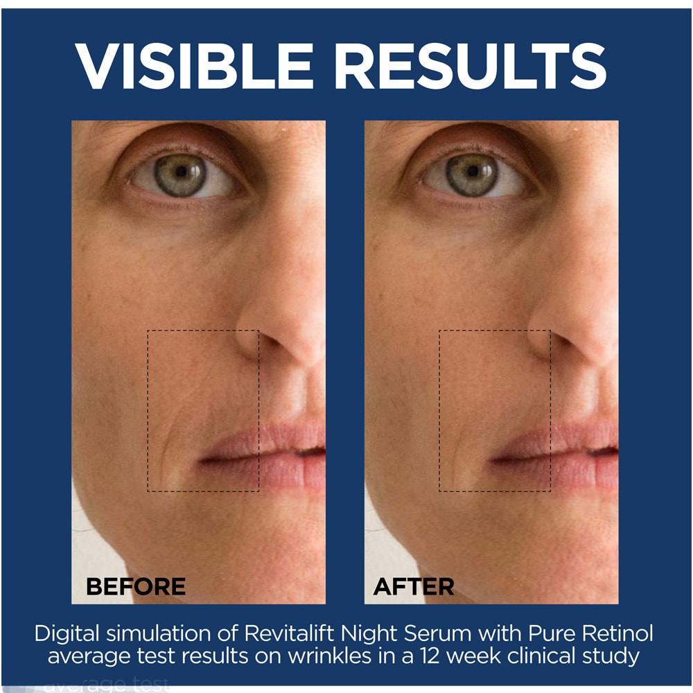 Revitalift Night Serum, 0.3 Pure Retinol L’Oréal Paris